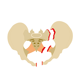 hip scan infographic in circle