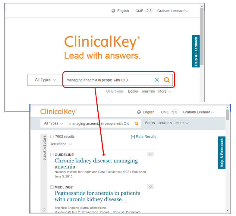 Screenshot of the Elsevier's clinical search engine showing a search term and the results it generates