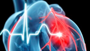 Thousands to benefit as NICE set to recommend  drug to prevent heart attacks and strokes