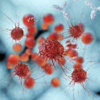 Life-extending breast cancer drug approved by NICE in draft guidance 