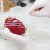 Antibiotic resistance is now “common” in urinary tract infections