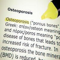 NICE says people with osteoporosis should be assessed for their fracture risk