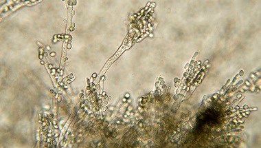 Double check patients with ‘penicillin allergy’ to avoid increased MRSA risk