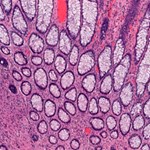 Cancer tests 200x200