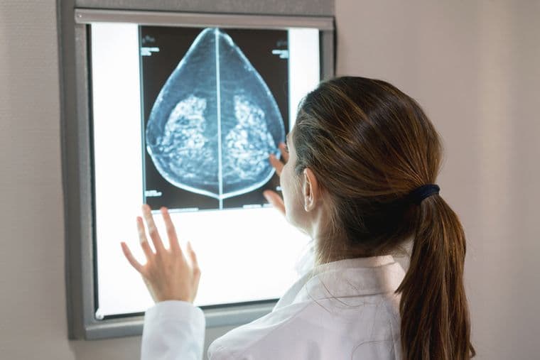 A clinician examining a mammogram